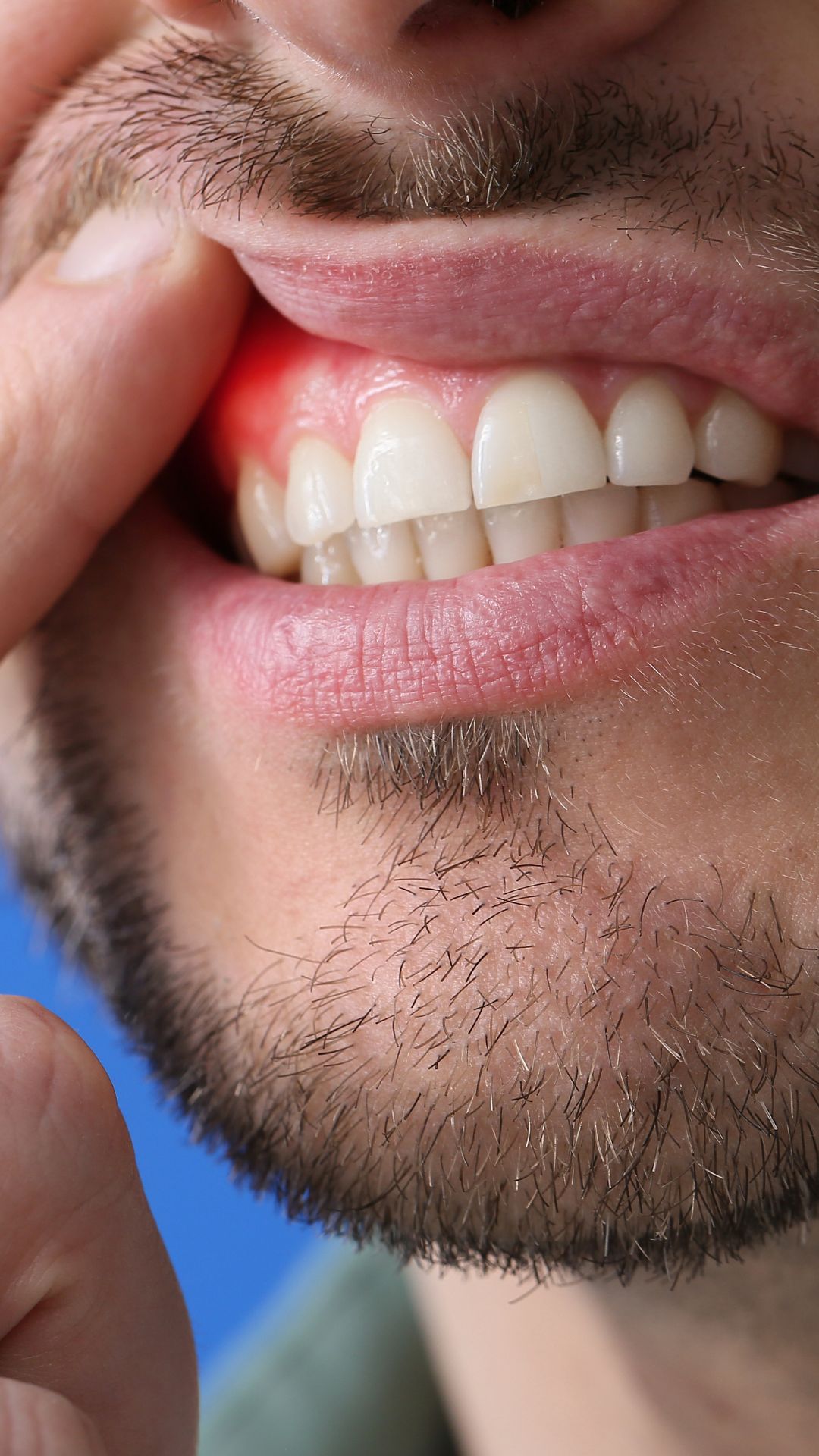 10.GUM SURGERY 10.GUM SURGERY
