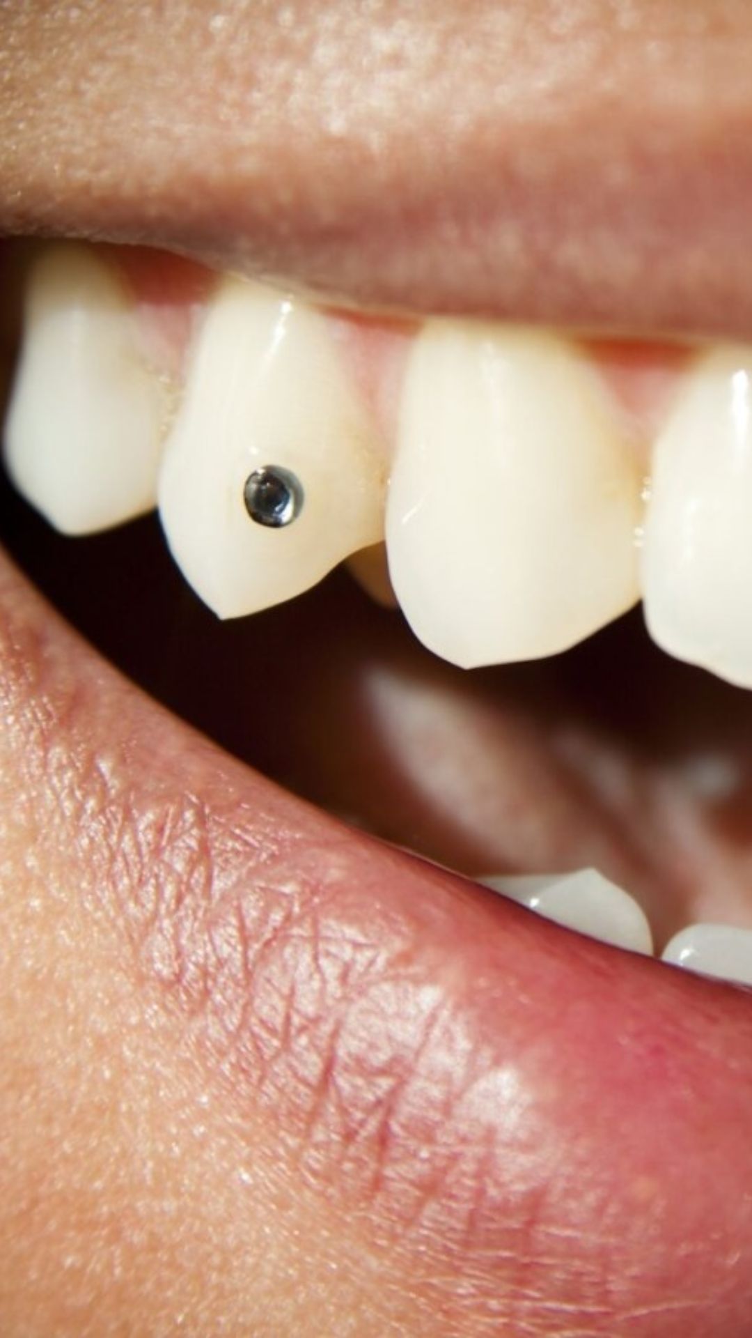 11. TEETH JEWELRY 11. TEETH JEWELRY